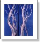 Tree Scape Pair